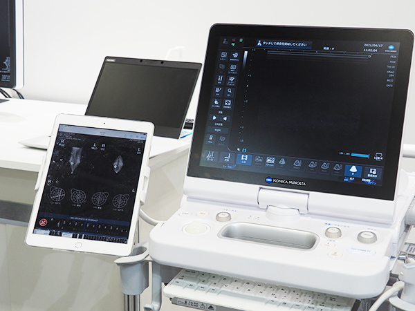 マンモグラフィ画像診断システム「FINO. VITA. PX type MG」。タブレットに表示されたエコーシェーマで病変位置を確認しながら超音波検査を行える。