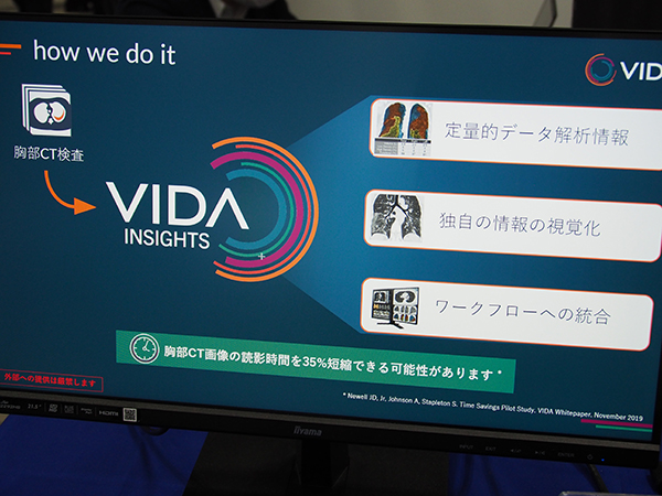 画像解析ソフトウエア「VIDA Insights」（クレアボ・テクノロジーズ社）も紹介