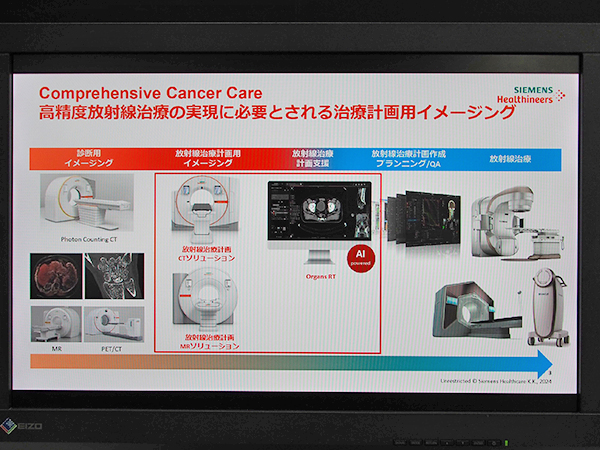 “Comprehensive Cancer Care”を実現するソリューション