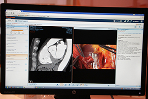 CTのMIP像と手術映像を分割画面で表示。元データをそのままハンドリング可能。