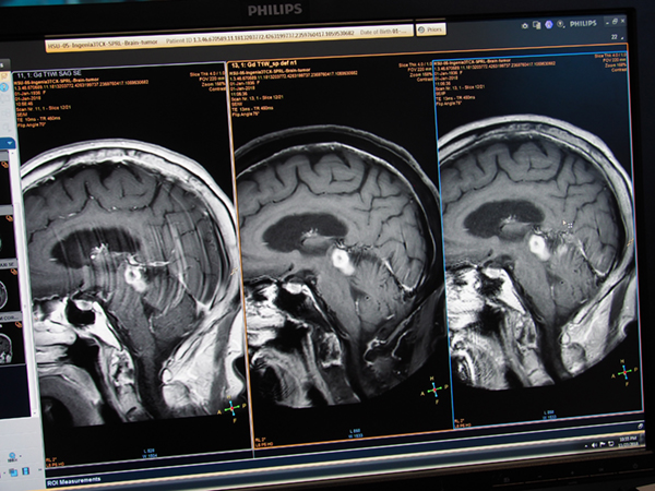 従来の画像（左），mDIXON併用“Spiral Brain”（中央），“Spiral Brain”（右）