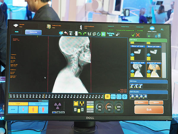 X線動画撮影システムの表示画面（FDA申請中）