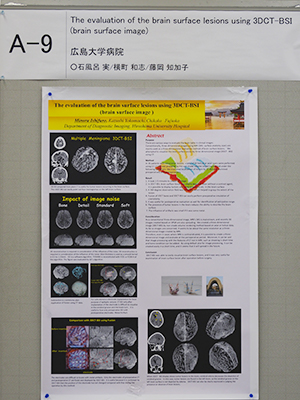 Certificate of Merit The evaluation of the brain surface lesions using 3DCT-BSI（brain surface image） 石風呂　実 氏（広島大学病院）ほか