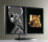 New Generation CORONIS