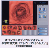 Bf-NAVI