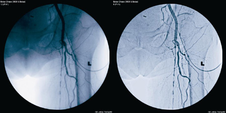 ]@ijOEC 9900 EliteiEjŎBeǑe摜GEƎDRMɂAǂ𖾗Ăɕ`o