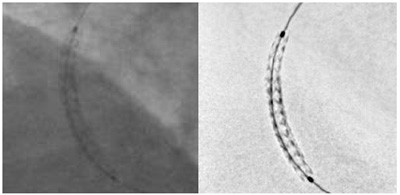 ]̃Xeg摜ijƁuStentVizvgpXeg摜iEj