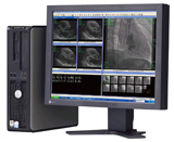 SYNAPSE CardioVascular