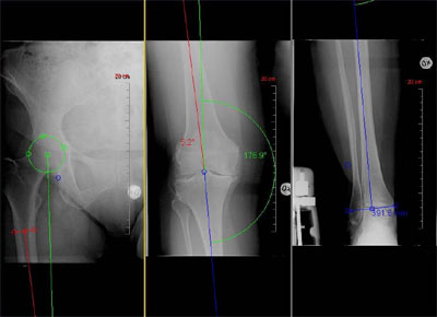 `OȐfÂɓvC[WiAځAGAj