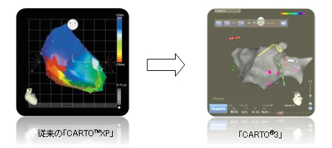 ACL(Advanced Catheter Location)ɂJe[e̐mȎo