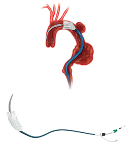 Zenith TX2 TAAGhoXL[Otg