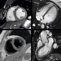 IngeniaŎBeS̃VlBlack BloodC[WO