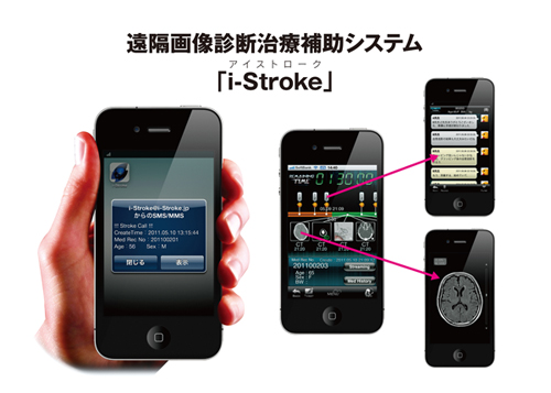 u摜ffÕ⏕VXe ui-StrokeiACXg[Njv