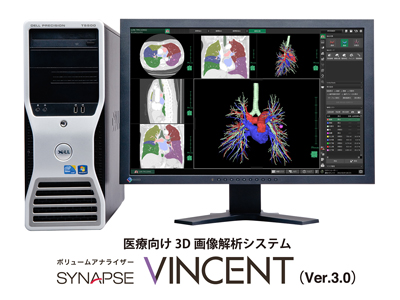Ì3D摜̓VXeuSYNAPSE VINCENT iVivX BZgj Ver.3.0v