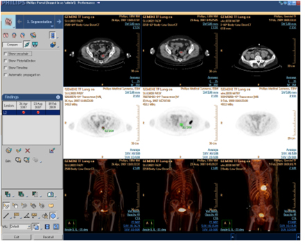 腫瘍経時観察機能画面の一例