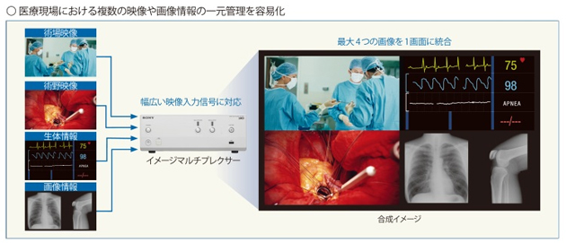 C[W}iÌɂ镡̉f摜̈ꌳǗj
