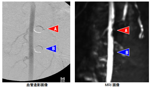 ʐ^ 1⌌Ǒe摜 MRI摜̔r