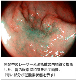 J̃[U[ڂ̓ŎBeA݂̎_fOax摜B