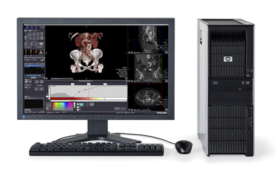 医用画像処理ワークステーションVitrea