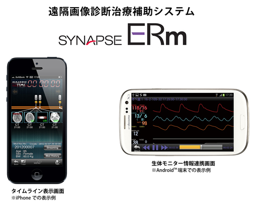 遠隔画像診断治療補助システム「SYNAPSE ERm」