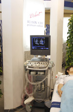 ACUSON X300 premium edition