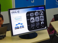 Hەa@ł̗Տpn܂ĂIDEAL-IQ̐