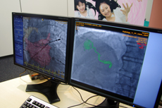 EP VisionCFlightPlan for Liver̃fXg[V