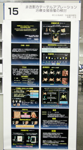 fUC 15u񑢉eJe[eAu[VÎx摜̌