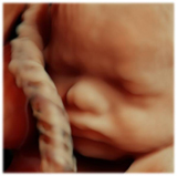 Voluson E8 HD Liveɂَ̉摜