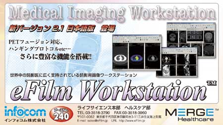 CtHR@eFilm Workstation