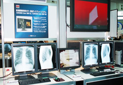 CORONIS Color 3MP DL()@CORONIS 3MPiEj