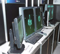 ÎɐݒuꂽCORONIS 5MP MAMMO