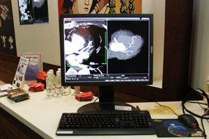 Sliding thin Slab MIP