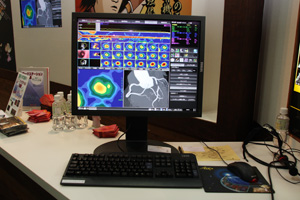 Sliding thin Slab MIP