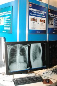 Coronis Fusion 6MP DL