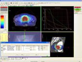 IMRTpːÌvVXeuMonacoiiRjv