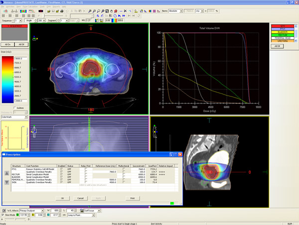 IMRTpːÌvVXeuMonacoiiRjv