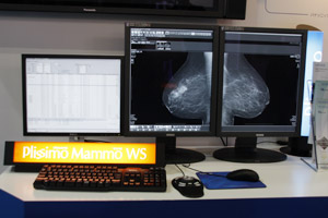Plissimo Mammo WS