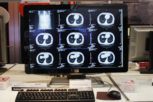 Coronis Fusion 6MP DL