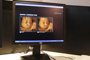 _eB掿P\tgEFAuGOPViewv