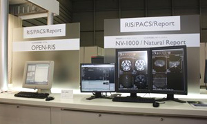 右側が,画像診断ワークステーション「NV-1000」と読影レポートシステム「Natural Report」を組み合わせた統合読影環境