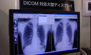 uLumiImagervV[YFVT250ɂʃj^ւ̕\