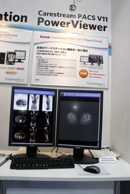 Kodak@Carestream PACS@V11 PowerViewer