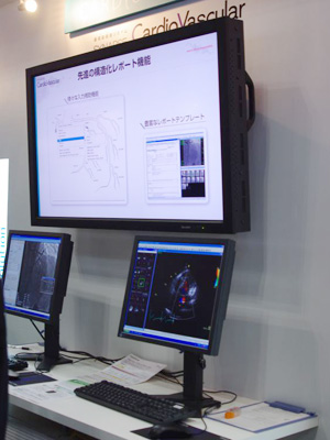 SYNAPSE CardioVascular