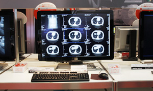 Coronis Fusion 6MP DL