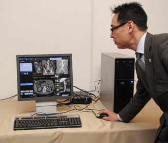 syngo.viaLҔ\ɂNCAg[pfXg[Vi