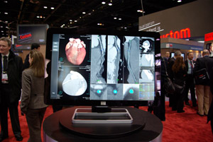 Coronis Fusion 6MP DL