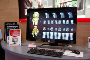 nCGhCoronis Fusion 6MP DL