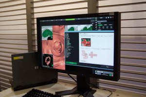 T[o^CvDSYNAPSE VINCENT