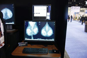}OtBpMonochorome LCD Monitor